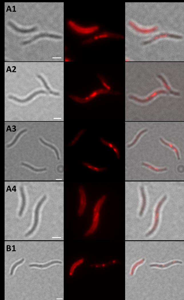Suppl. Fig. S3: Expression of DsRed2EC-LactC2 in PHB granule-free M. gryphiswaldense phacab mutant. Cells focussed to filament-like dsred2ec-lactc2 fluorescence resembling magnetosome chains (A1-A4).