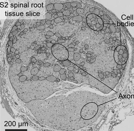 gradált receptorpotenciál Szinapszis Sejttest Perifériás nyúlvány (dendron) Sejttest: - ganglion spinale - agyidegek érződúcai (pl.
