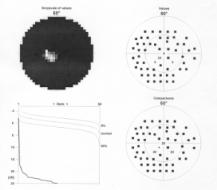 Nagy vakfolt jel (Big Blind Spot