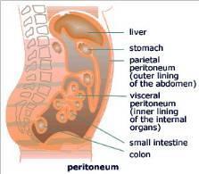 Primer tumorok Mesothelioma Benignus Malignus Desmoplastic