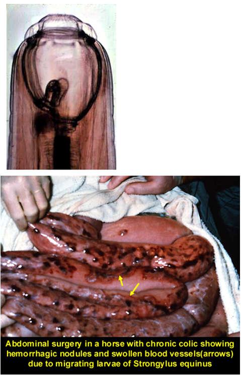 paraphlebitis, phlebitis és thrombosis (v.