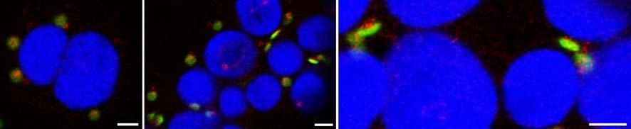 Supplemental Figure 9 Supplemental Figure 9. Co-localization of GFP-SUC4 and the Golgi/TGN marker Wave25R in ap-3 protoplasts.