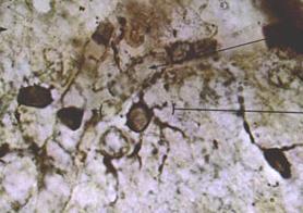 of oligodendroglial