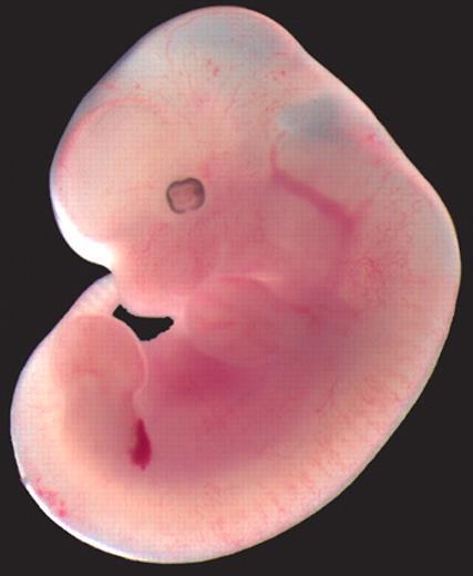 medial ganglionic eminence Sárga: GABA-erg interneuronok vándorlása