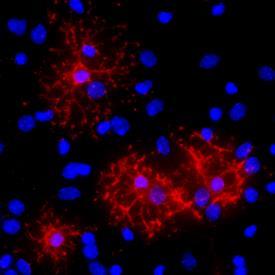 Oligodendrociták (ODC) és progenitorjaik (OPC) Markerek Olig2 Oligodendrocyte transcription factor 2 - bhlh transzkripciós faktor - gv-ben ventrális neuroektodermális sejtsors specifikáció