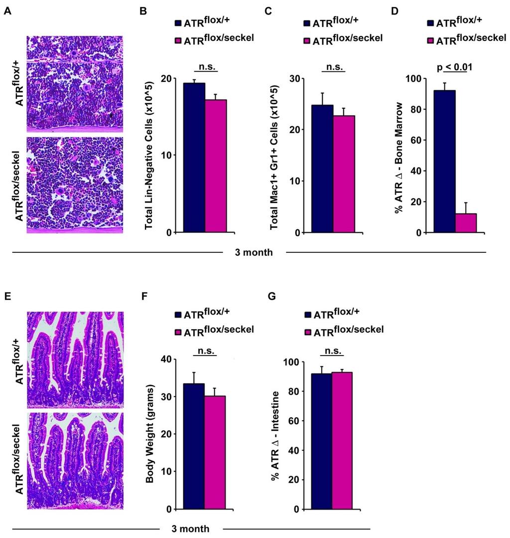 Supplemental Figure 4 Supplemental Figure 4. ATR suppression does not overtly affect bone marrow or intestinal homeostasis for extended periods of time.