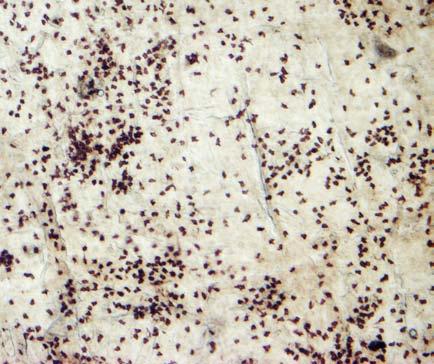 EREDMÉNYEK EREDMÉNYEK I. 1. Az epidermális dendritikus sejtek fenotípusa A bőrhám DC-jeinek a vizsgálatát először fiatal felnőtt (8 hetes) állatokon végeztük.