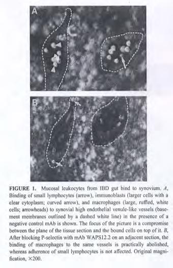 IBD bél leukocyták