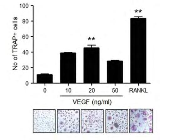 VEGF osteoclastogenesis RA-ban Monocyta