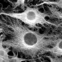 filamentum) (4 kép: GFAP immunfestések