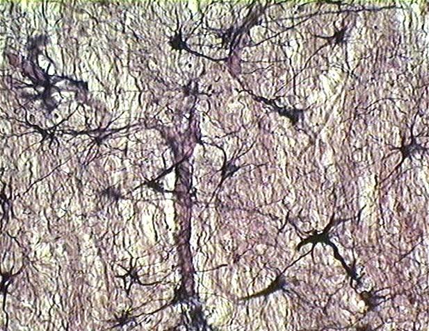 mm3. (Dr Szigeti Cs.