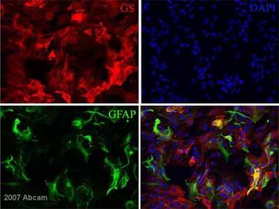+ phosphate Glutamin synthase/gfap Aquaporin 4 (asztro