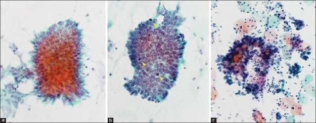 Cytojournal. 2015; 12: 8.