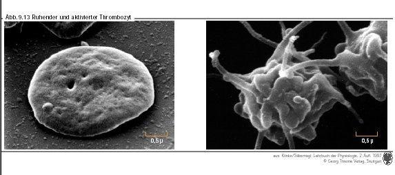 Thrombocyta dugó kialakulásának lépései: 1. Thrombocyták adhéziója a sérült érfalhoz 2.