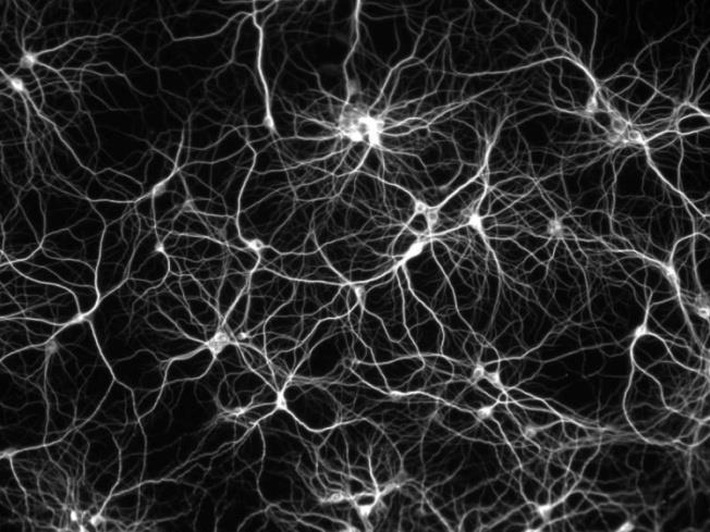 Neurális hálózat - neuronok Neuron doktrina: S. Ramón y Cajal (1852-1934) Mesterséges neuron: W. McCulloch and W. Pitts, 1943 Tanulás: D.