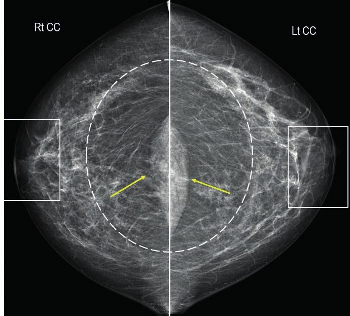 of Mammography, Falun, Sweden Egy röntgenasszisztensnek nagy szakértelemmel kell rendelkeznie ahhoz, hogy a legjobb munkát nyújtsa mind a