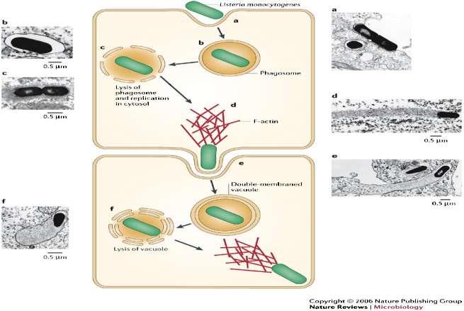 Listeria monocytogenes