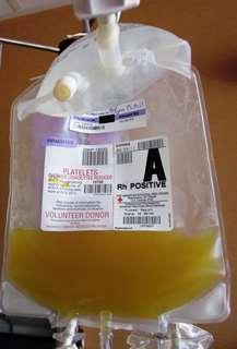 Trombocita transzfúzió gyakorisága Pandey S. et al: Transfusion S 52. 65S-79S. 2012. Mc Cullough J: Transfusion Medicine 3th edition 238-304. 2012.: Többször kevesebbet (beavatkozás előtt 1-2 órával) Vérzéskockázat, gyakoriság nem különbözik: thr szám 5.