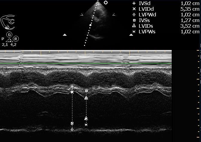 Ultrahang diagnosztika Impulzus-echó módszerek III.