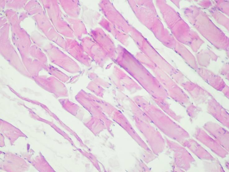 Myoglobinuria lovakban