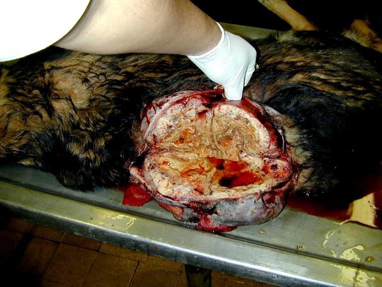 Fibrosarcoma