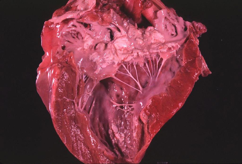 Kutya, szív: endocardialis