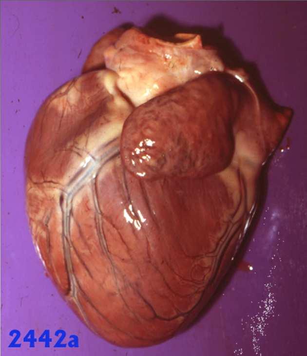 szívbetegségek egészségügyi vonatkozásai)