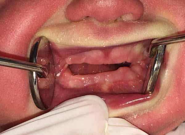 preraoperative