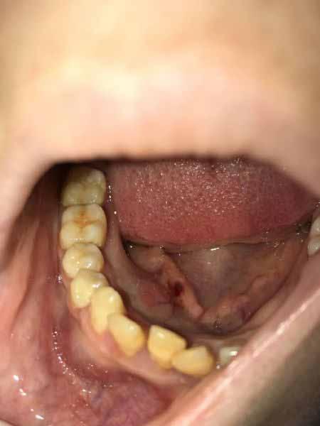 Pre-op Intraoral Image Notice