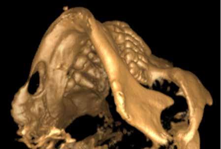 PP-015 Stafne Bone Defect: Report of Two Cases Rıdvan Güler, Bekir İlyas, Kamil Serkan Ağaçayak Dicle University, Faculty of Dentistry, Departmant of Oral and Maxillofacial Surgery, Diyarbakır,