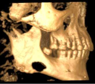 CBCT
