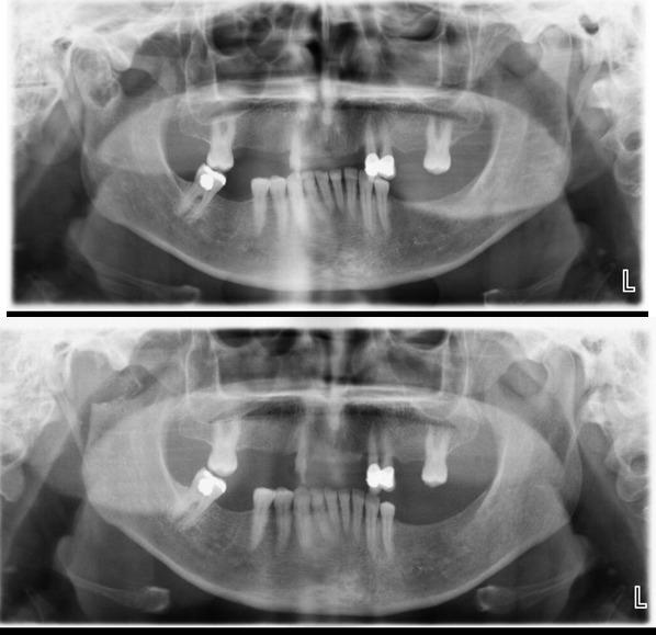 preoperative