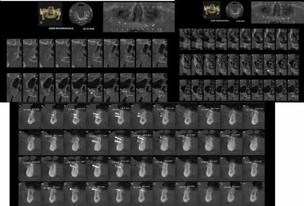 tomographic images