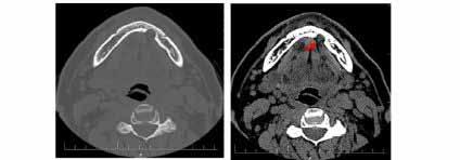 Fig.2 a,