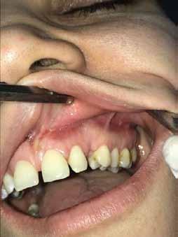 radiograph