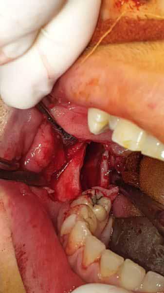 anesthesia (1) l