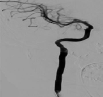 Note the close anatomical relation of the lesion to the base of skull.