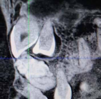 CBCT figure 3 