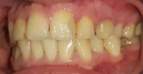 figure 4 Postoperatif