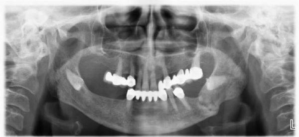 Figure-3 View of the