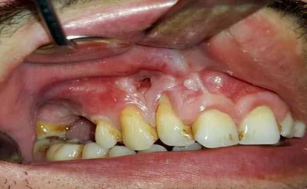 Figure 2 Intraoral view of
