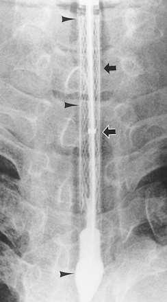 Trachea stent Ho-Young Song, Tae Sun Shim, Sung-Gwon Kang, Gyoo-Sik Jung,