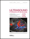 afro-karibi lakosság rövidebb. Interobserver szórás nagy. Orlandi, F., et al.