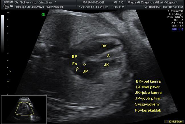 Ultrahangvizsgálatok a terhesség során - PDF Ingyenes letöltés