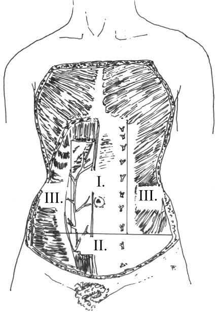 DR. VÉGH MIKLÓS circumflexa ilium superficialis, az arteria és vena epigastrica inferior superficialis, valamint az arteria és vena pudenda externa biztosítja.