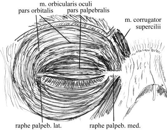 DR KAMARÁS NÓRA 2.2 ANATÓMIA Dermatochalasis "baggy lids" Táskás szem (ez az állapot gyakran látható középkorú, vagy idősebb embereken.
