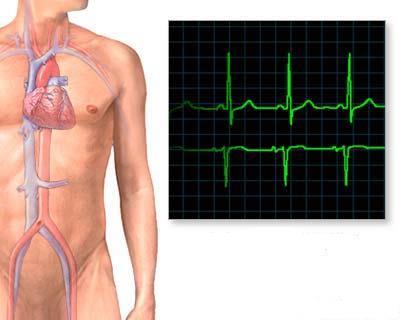 EKG alapismeretek Prof. Dr.