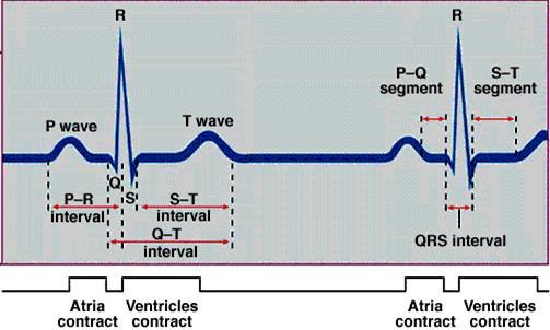 V. Az EKG hullámok nómenklatúrája P QRS T U atrialis aktiváció ventricularis aktiváció