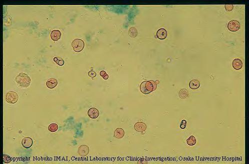 Glomerularis