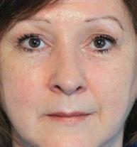 Termékszám 97101332 (fehér) 97101333 (fekete) ARCKEZELŐFEJ NU SKIN GALVANIC SPA SYSTEM FACIAL GELS WITH ageloc (KEZELŐ ARCGÉLEK AGELOC -KAL) Fiatalosabb megjelenésű bőr 5 perc alatt.
